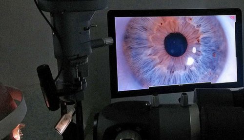 Израильский стартап получил одобрение FDA на методику лечения глаукомы лазером - «Технологии»